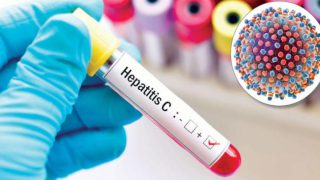 وزارة الصحة تطلق الحملة الأولى للكشف عن إلتهاب الكبد الفيروسي