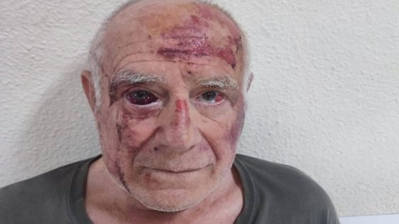 «اعتداء صادم يهز إسبانيا.. مسن سبعيني ضحية “ترفيه دموي” على يد شبان مغاربة!»