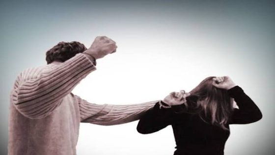 خلاف زوجي يتحول إلى اعتداء جسدي واستياء من تعامل أمني بمدينة الناظور